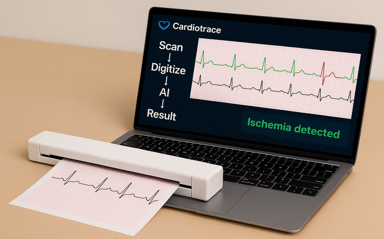 Cardiotrace scanner
